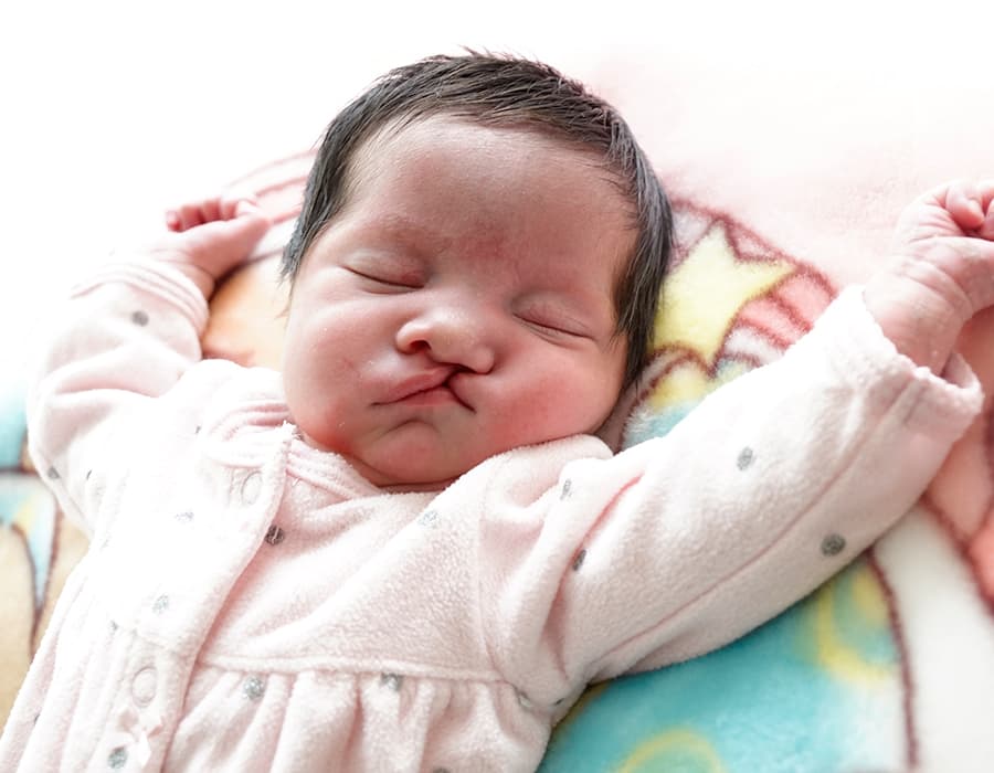 Costa-Rica-Comprehensive-Cleft-Care Costa-Rica-Comprehensive-Cleft-Care